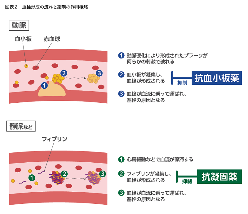 ドクタービジョン資料_循環器診療に役立つ抗血栓薬の使い方TIPS_p4_図表2_血栓形成の流れと抗血小板薬・抗凝固薬の作用概略