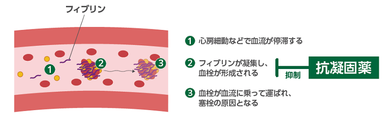 ドクタービジョン資料_循環器診療に役立つ抗血栓薬の使い方TIPS_p4_抗凝固薬の作用機序概略図