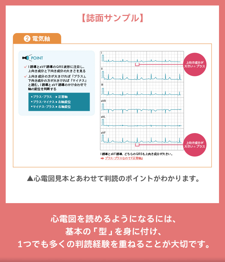 心電図スライド3