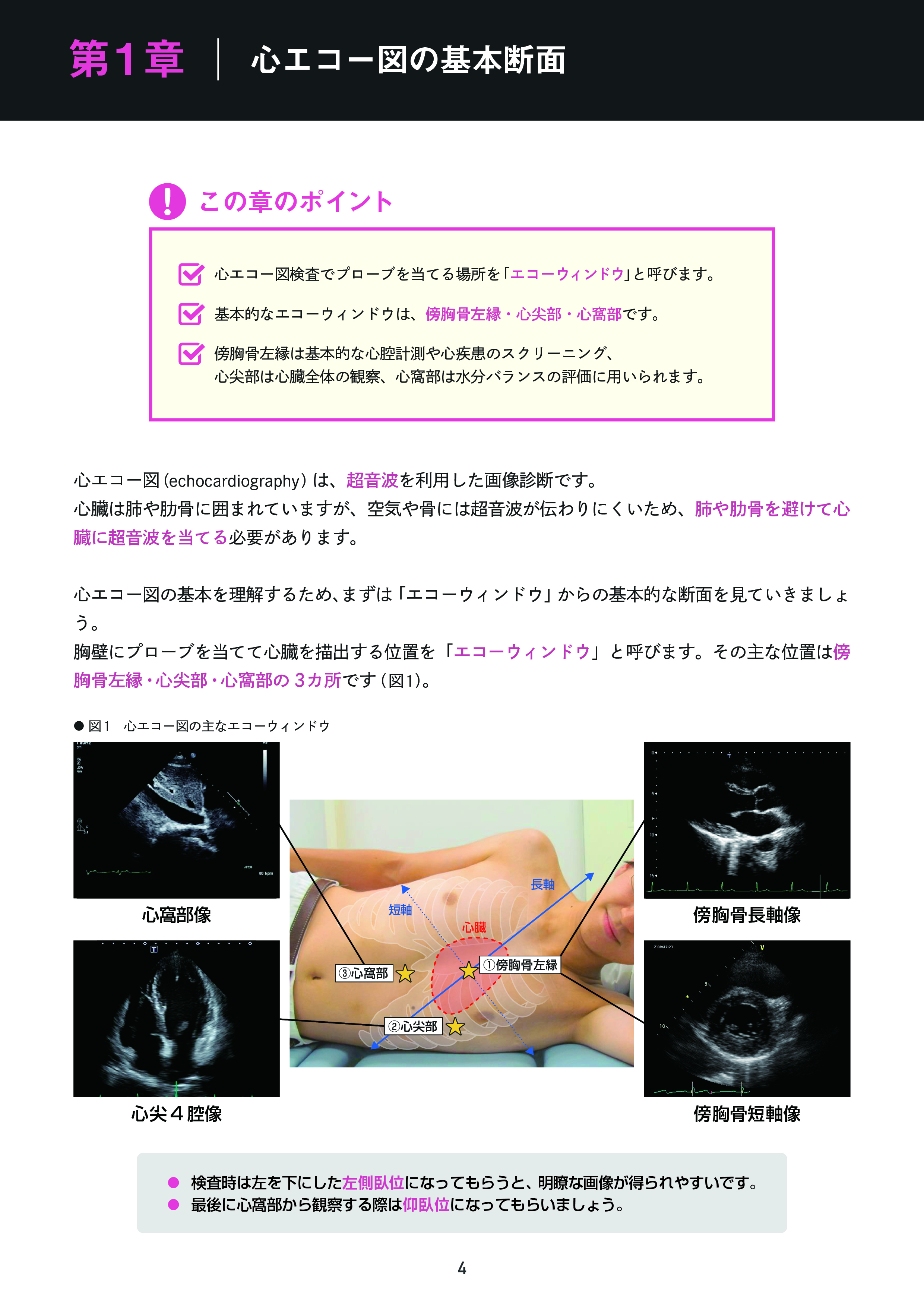 心エコースライド3